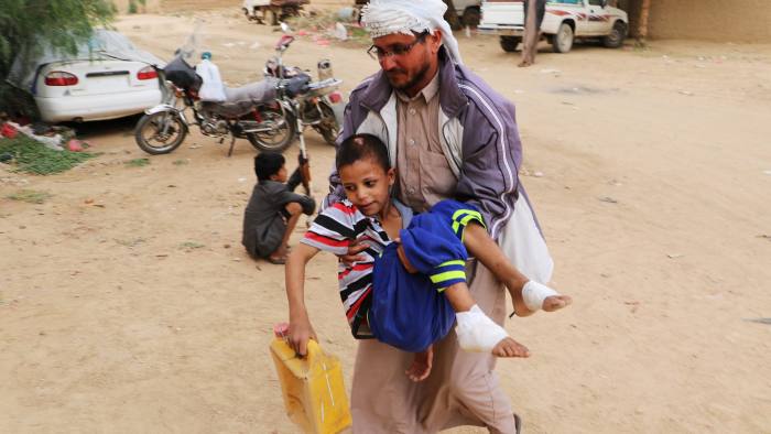 کودکان یمنی؛ نسل سوخته‌ای که باید بهای کشورشان را بپردازند