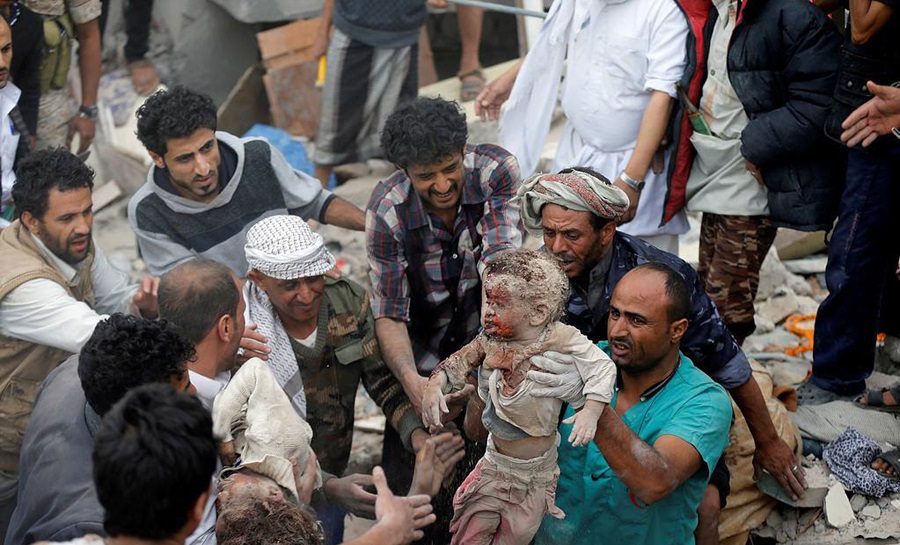 حال یمن از این بدتر نمی شود