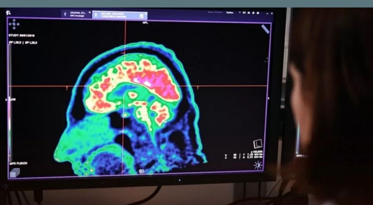 برای اولین‌بار در جهان؛ تومور مغزی بیمار ١٣ ساله به‌طور کامل درمان شد