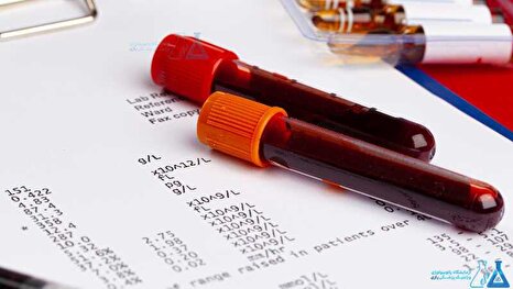 راهنمای کامل آزمایش خون به روشی ساده و قابل فهم برای همه