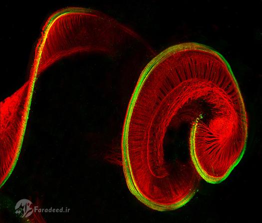 سلول ھای موئی شکل حساس به رنگ قرمز و سلول ھای عصبی به رنگ سبز در ساختار حلزون گوش یک موش دیده می شوند.
