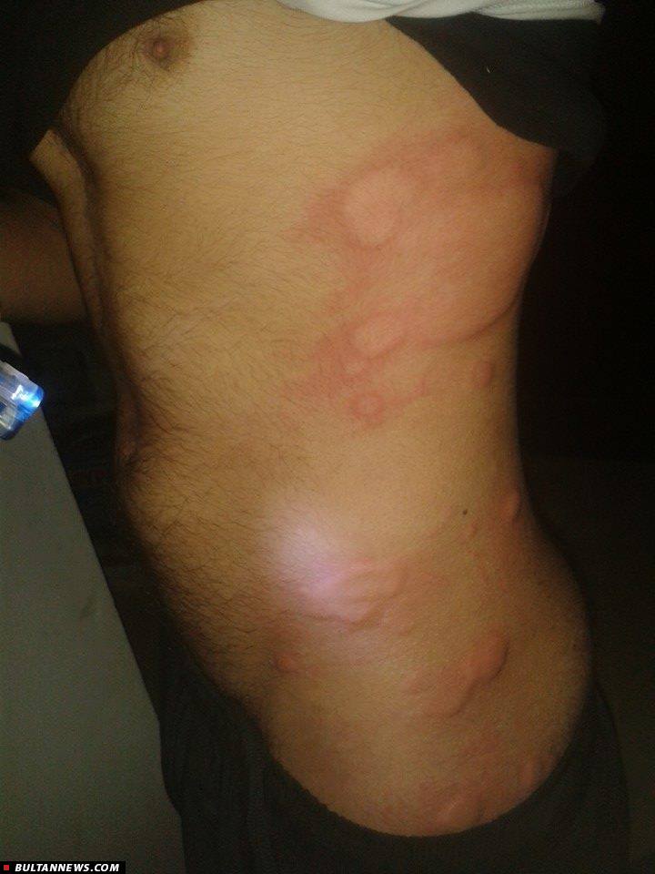 داعش از سلاحهای شیمیایی در کوبانی استفاده می کند