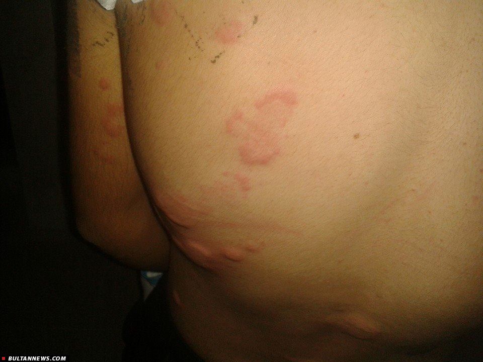 داعش از سلاحهای شیمیایی در کوبانی استفاده می کند