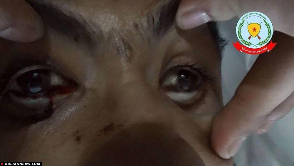داعش از سلاحهای شیمیایی در کوبانی استفاده می کند
