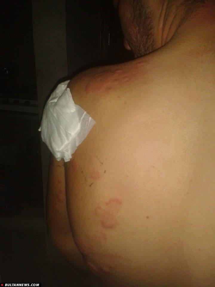 داعش از سلاحهای شیمیایی در کوبانی استفاده می کند