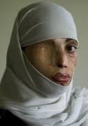 ريختن اسيد بر چهره پاك و نورانی امر به معروف و نهی از منكر