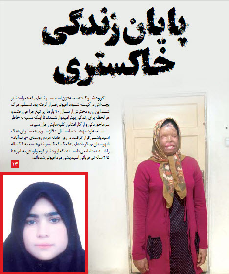 قربانی اسید پاشی جان باخت + عکس