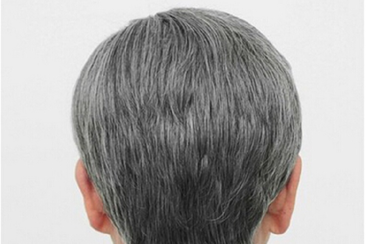 ژن مرتبط با سفید شدن مو را دانشمنداان شناسایی کردند