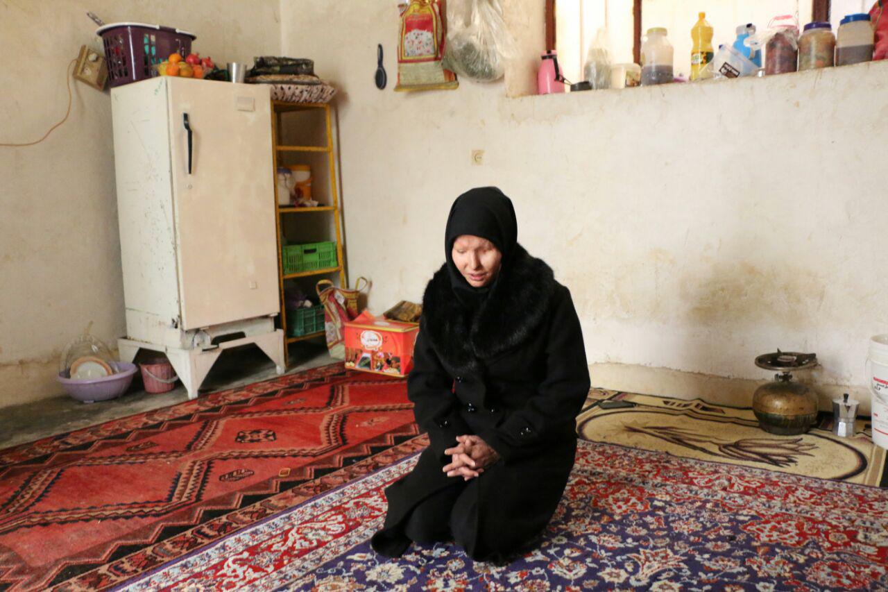 برای این دختر که چشمانش را به خاطر اسید پاشی از دست داده دعا کنید