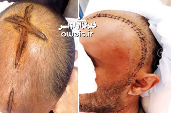 بلایی که پزشک محلی سر بیمار آورد + عکس