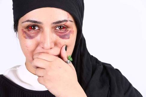 چهره عجیب باران کوثری در روز تولدش! عکس