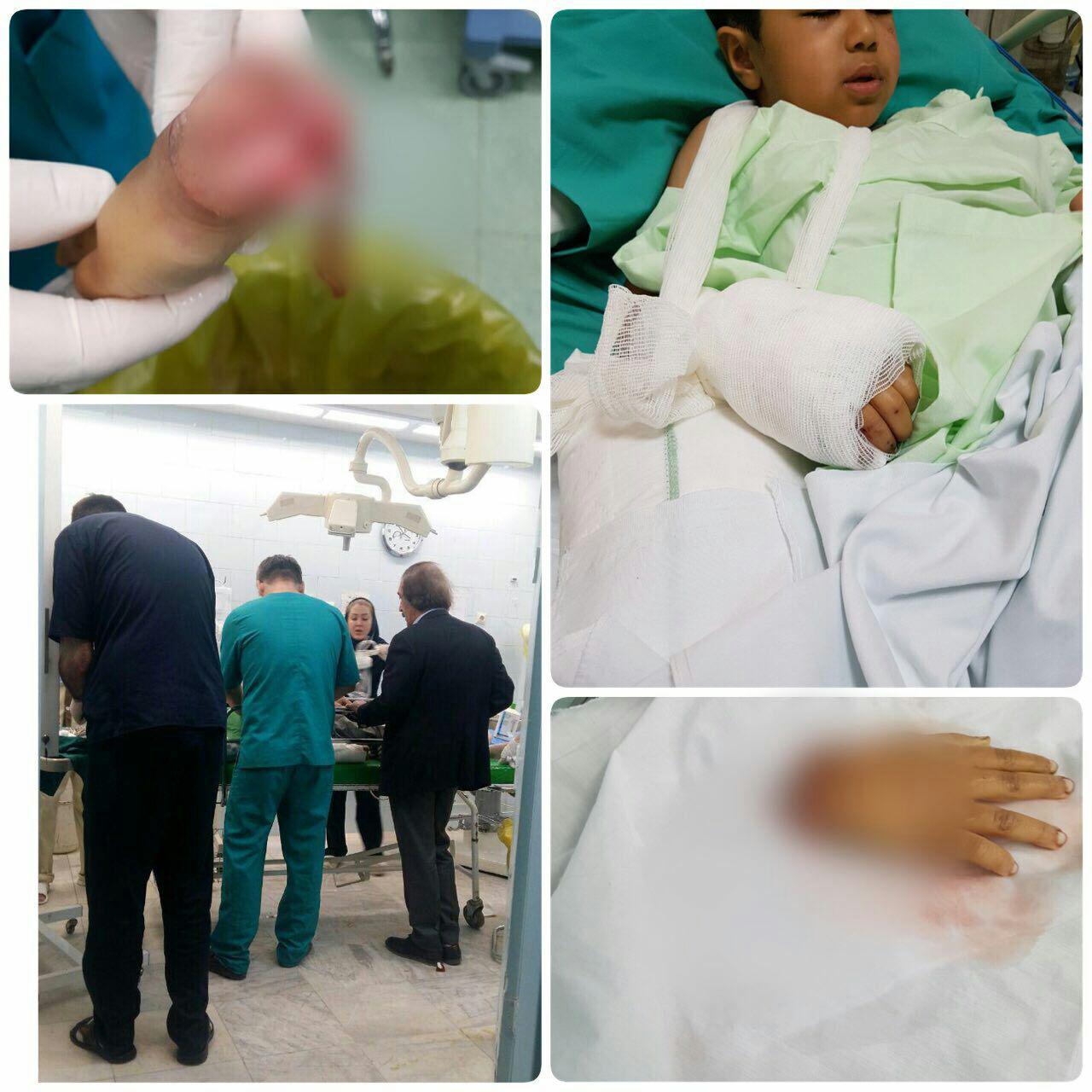 دست قطع شده کودک زلزله‌زده پیوند زده شد + عکس