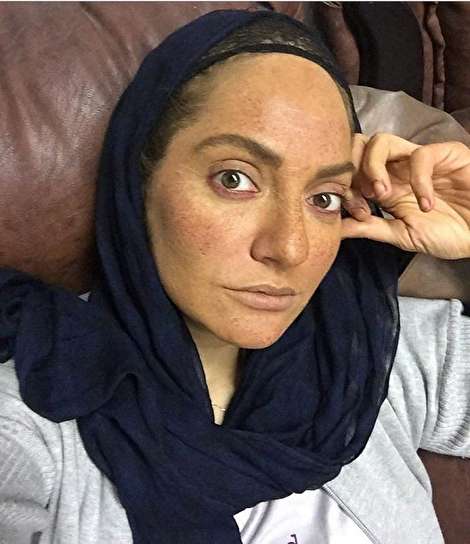 واکنش وزارت بهداشت به تبلیغات مهناز افشار درباره یک آمپول!