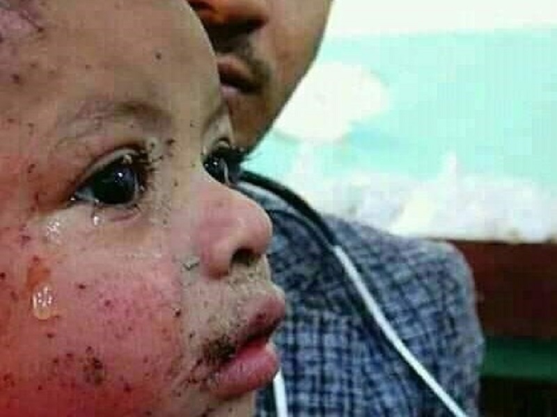 شیرخواره ۹ ماهه تازهترین نماد مظلومیت ملت یمن+ عکس شیرخواره ۹ ماهه تازهترین نماد مظلومیت ملت یمن+ عکس
