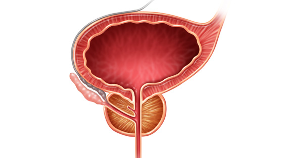راه جلو گیری از ابتلا به بیماری پروستات
