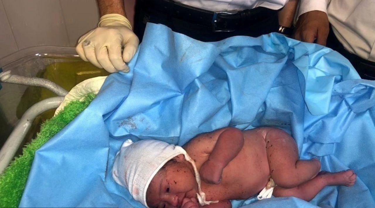 اولین تصاویر نوزاد پیدا شده در یکی از سطل‌‌های زباله پایتخت