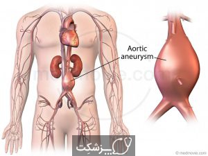 موفقیت عمل Evar در بیمارستان ایرانشهر