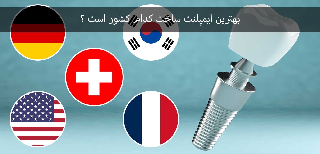بهترین ایمپلنت ساخت کدام کشور است؟
