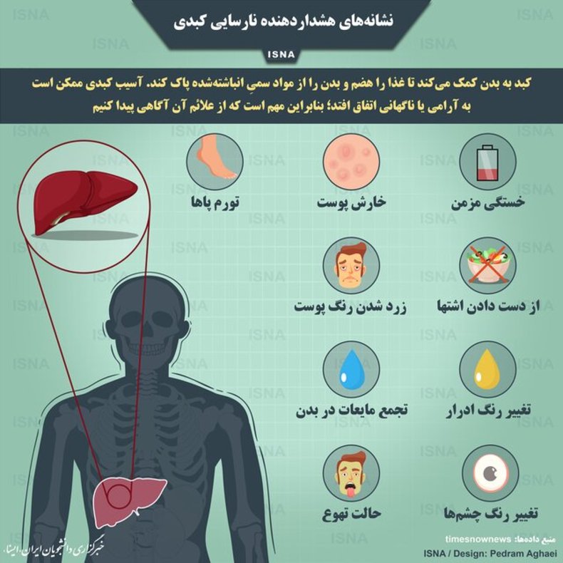 اینفوگرافیک / نشانه‌های هشداردهنده نارسایی کبدی