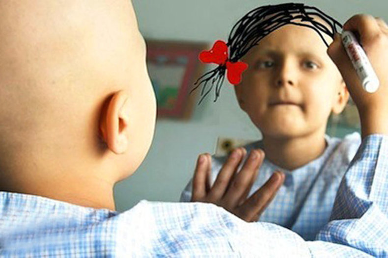 علایم یکی از سرطان‌های شایع کودکان