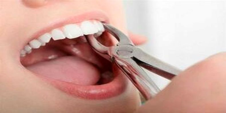 از دست دادن دندان عقل این حس شما را چند برابر می کند