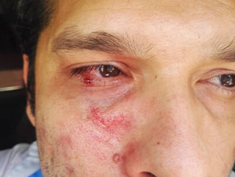 کتک زدن کارشناس بهداشت در تنگستان!