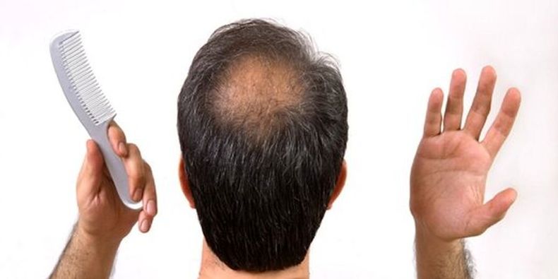 اگر موهای کم حجم دارید این ۷ اشتباه را مرتکب نشوی
