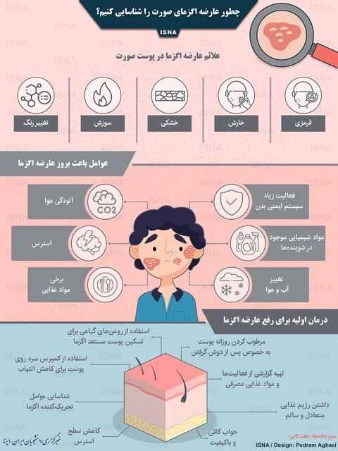 چطور عارضه اگزمای صورت را شناسایی کنیم؟
