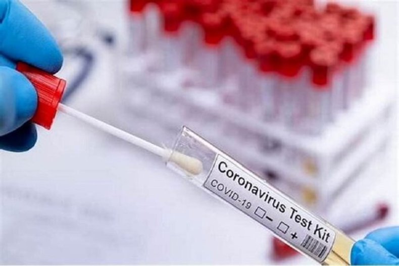 فهرست جدید آزمایشگاه‌های مجاز تشخیص کرونا اعلام شد
