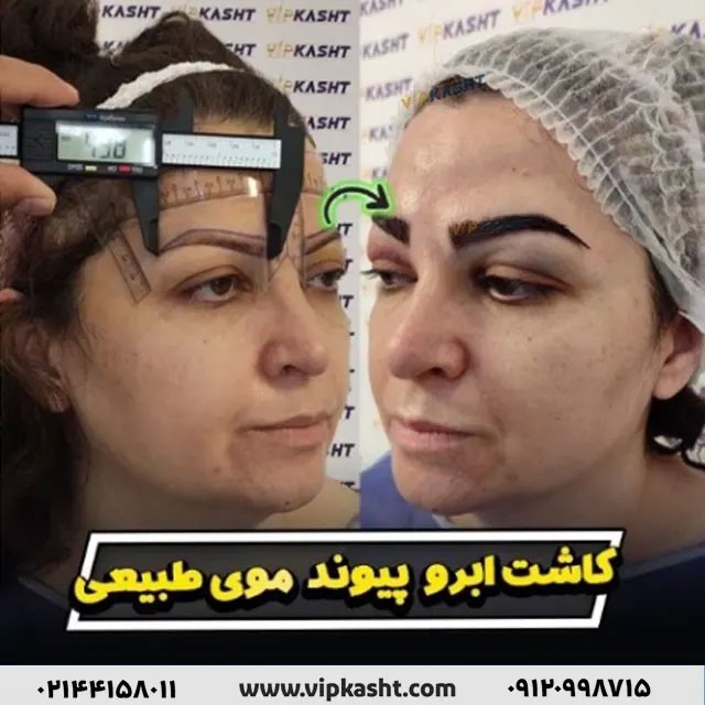 هزینه کاشت ابرو