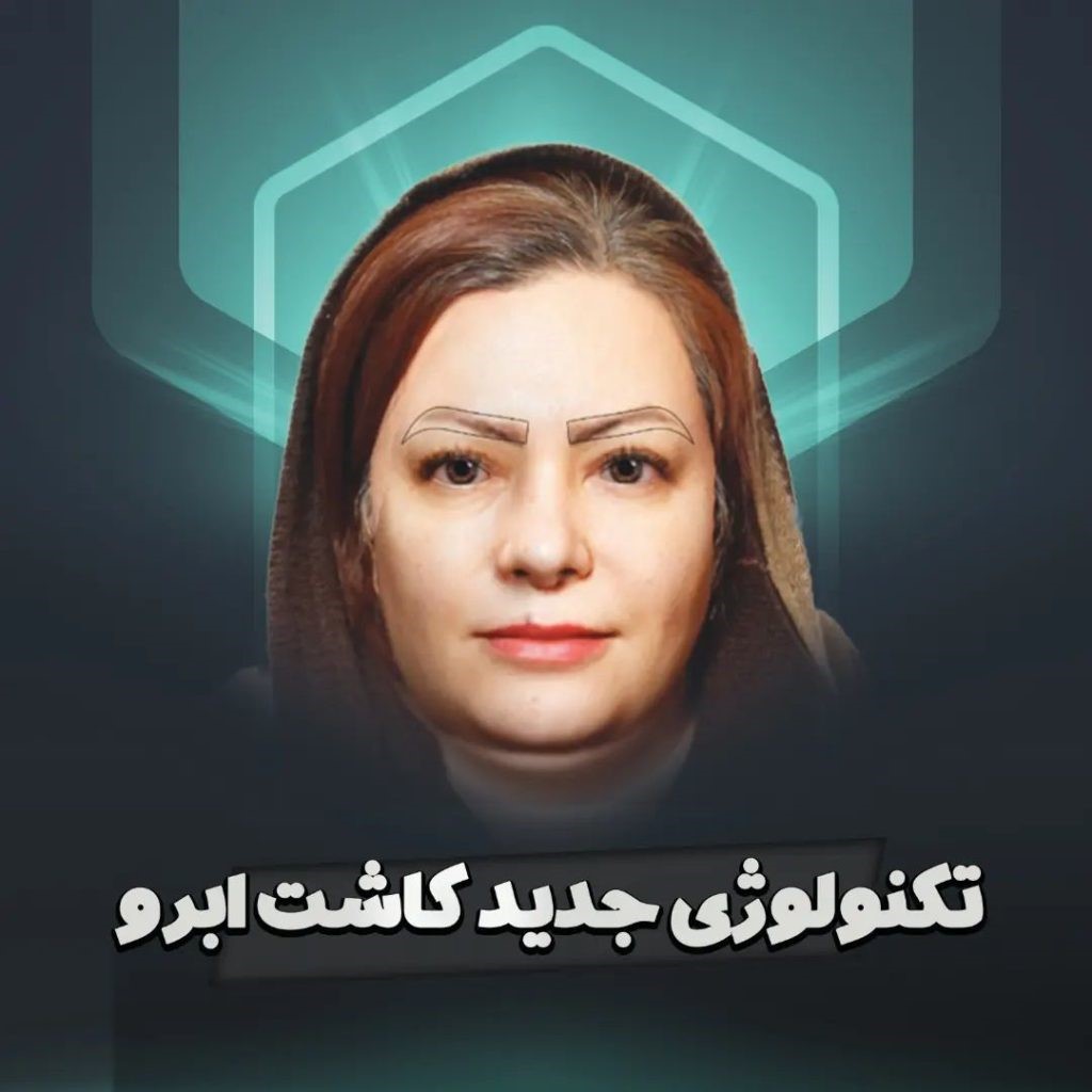 بهترین رو کاشت ابرو