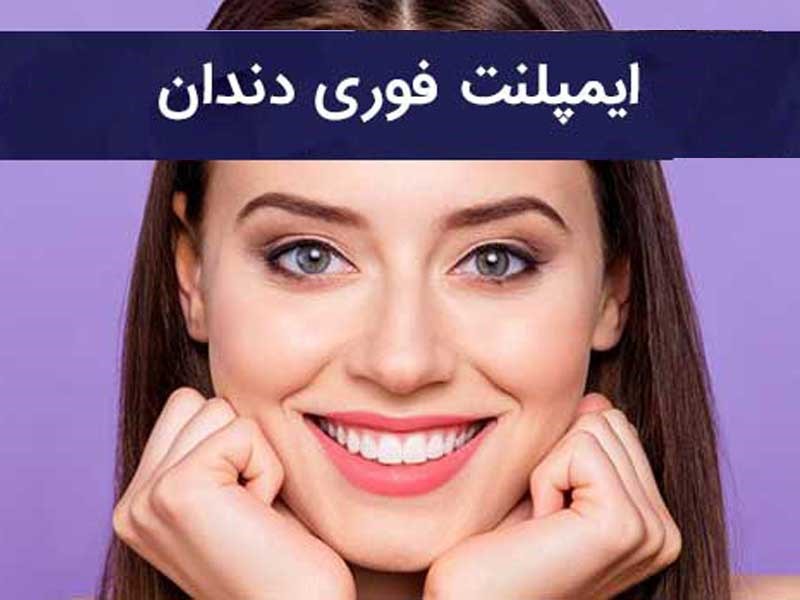 ایمپلنت فوری دندان تنها در یک روز | قیمت ایمپلنت فوری ایمپلنت فوری دندان تنها در یک روز | قیمت ایمپلنت فوری