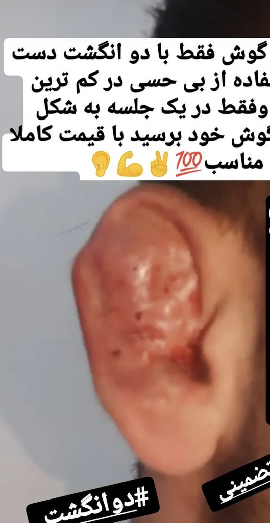 چند میگیری گوش بشکنی؟/ مدل‌های گل کلمی و حلزونی بالای یک میلیون تومان