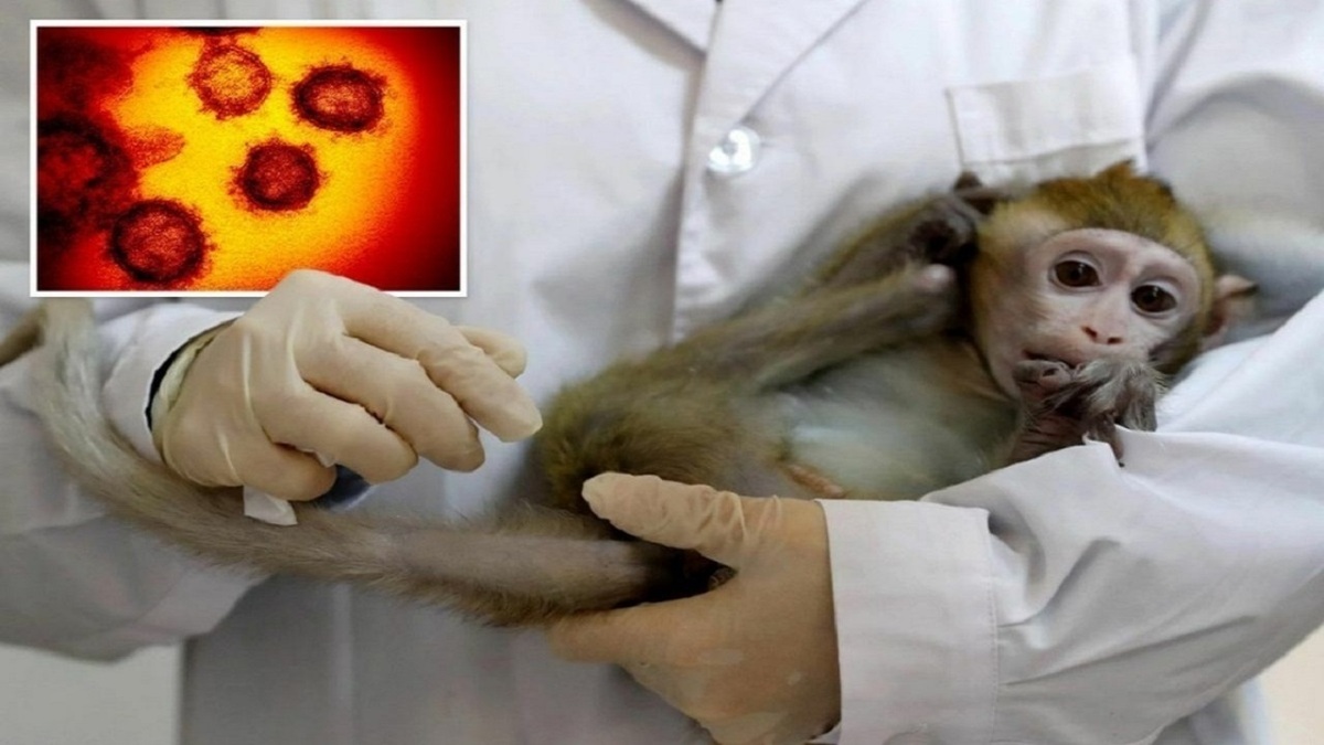 ٣٩ مورد مشکوک آبله میمونی در کشور