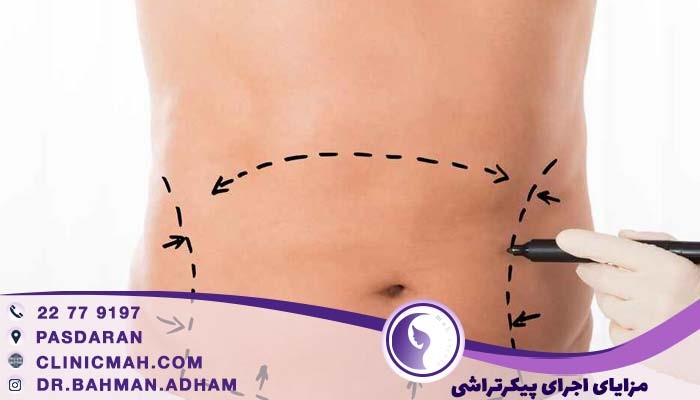 بهترین روش پیکرتراشی بدون جراحی
