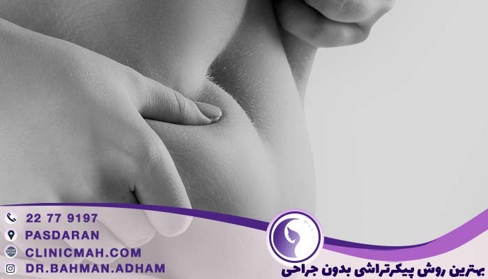 بهترین روش پیکرتراشی بدون جراحی