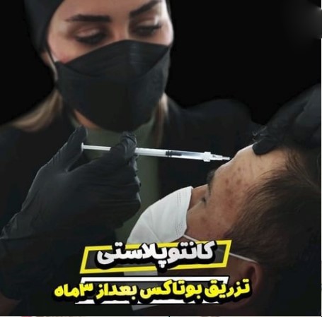 بهترین کلینیک عمل چشم گربه ای