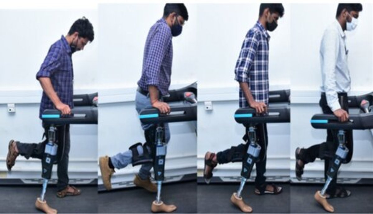 پای مصنوعی هوشمند؛ امیدی تازه برای راه‌ رفتن افراد قطع عضو