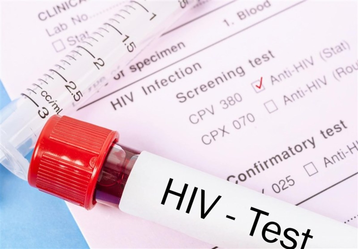 درمان رایگان و محرمانه مبتلایان HIV در ایران