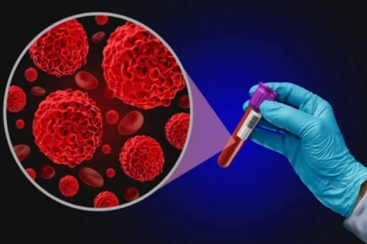 دانشمندان: تمایل به خودکشی را می‌توان با بررسی ترکیبات خون افراد تشخیص داد