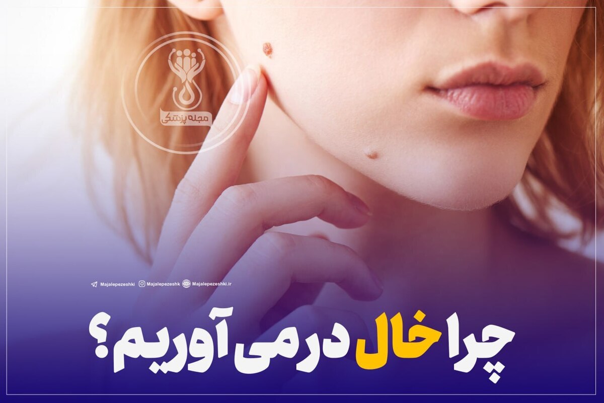 چرا خال در می آوریم؟