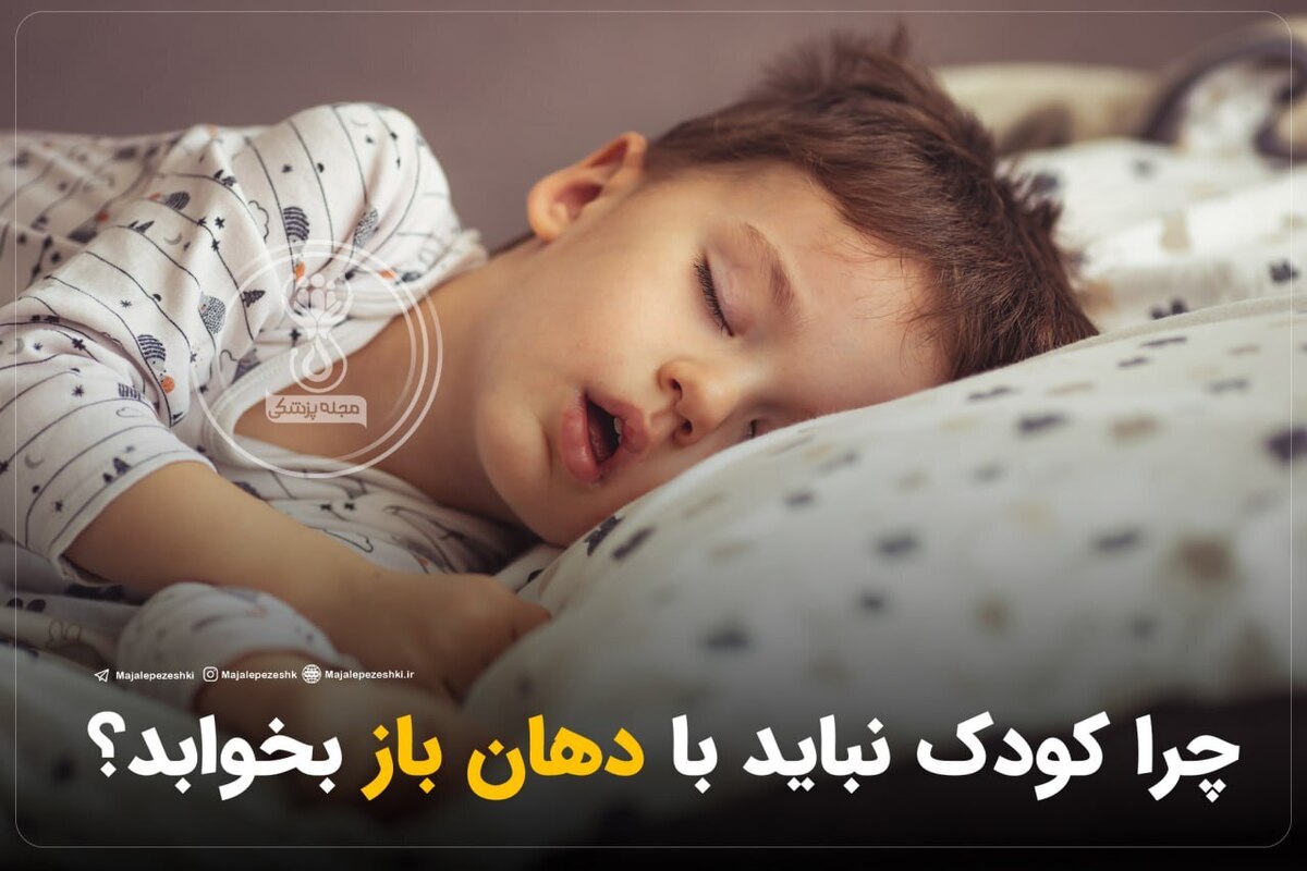 چرا کودک نباید با دهان باز بخوابد؟