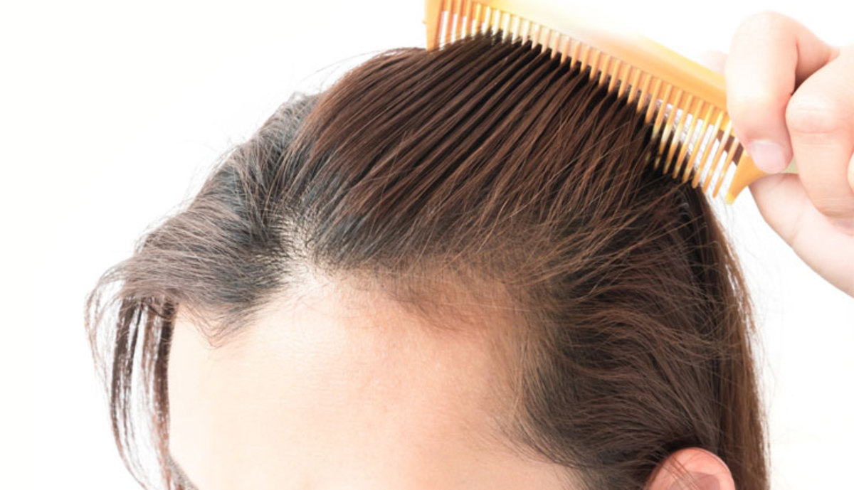 علت ریزش مو در تابستان و روش‌های پیشگیری از آن