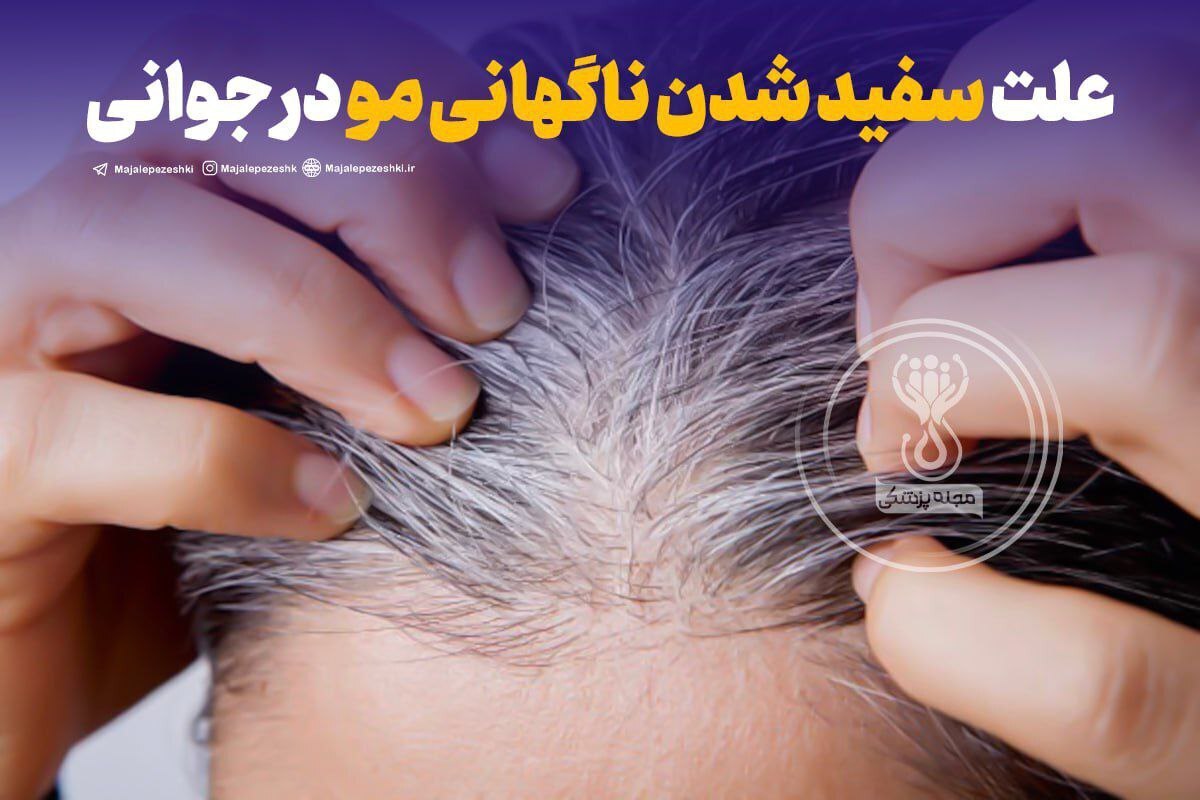 علت سفید شدن ناگهانی مو در جوانی و نوجوانی چیست؟