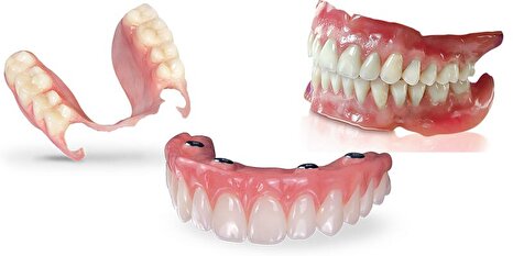 آیا دندان پزشکان به زودی بیکار می‌شوند ؟!