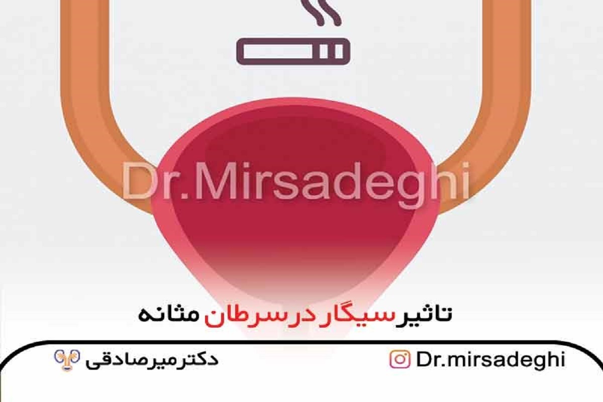 تاثیر سیگار در سرطان مثانه