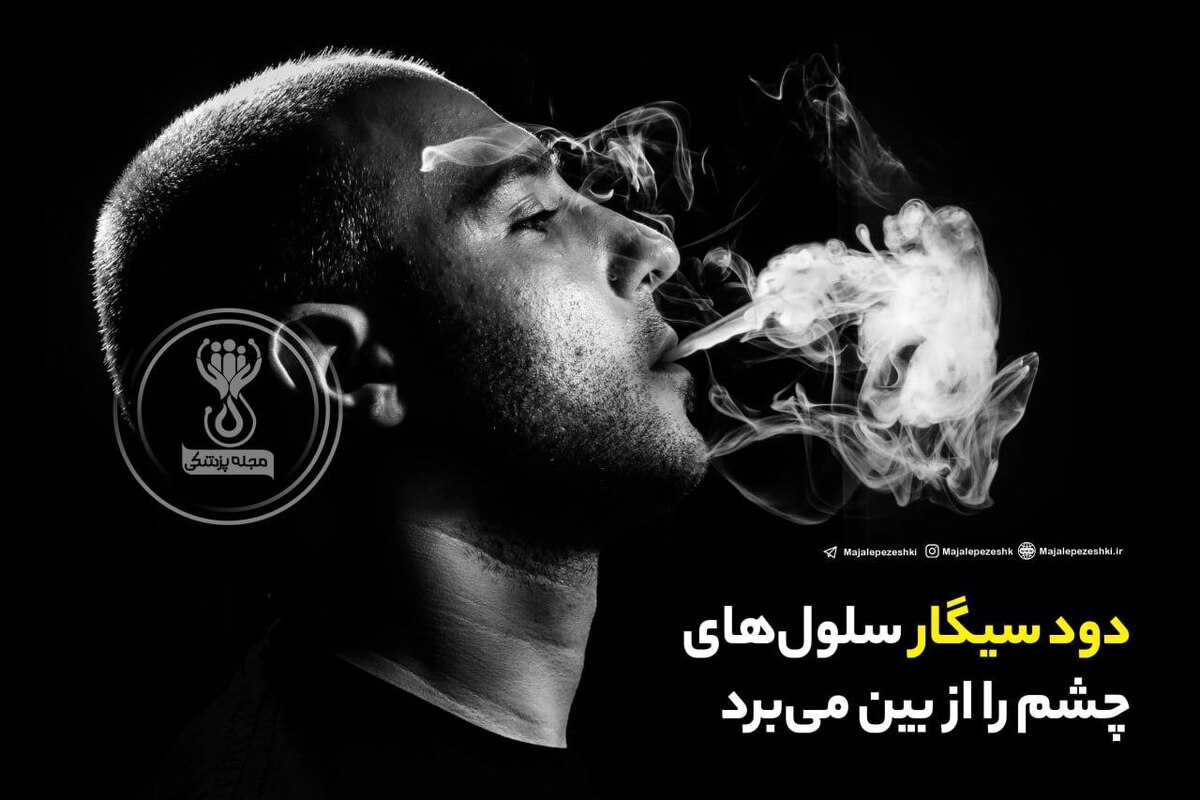 دود سیگار سلول‌های چشم را از بین می‌برد