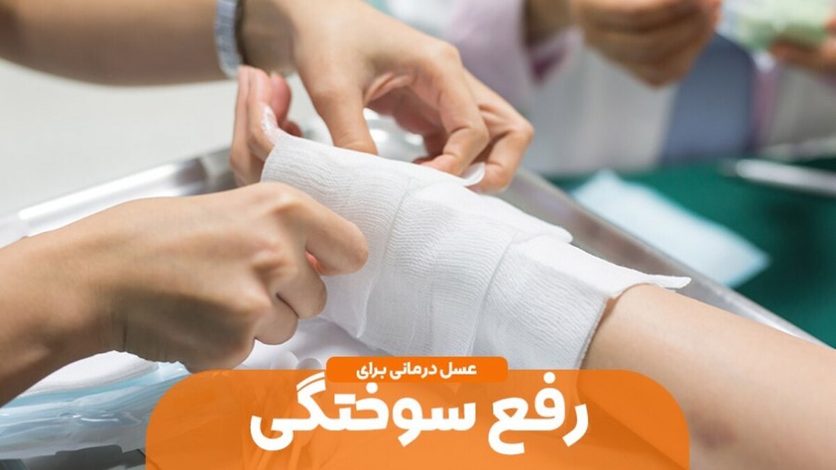 رفع سوختگی با عسل طبیعی | سوختگی های سطحی را با عسل ناپدید کنیم