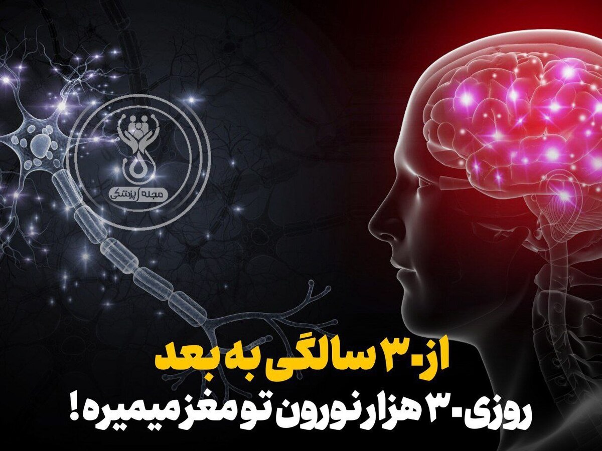 از 30 سالگی به بعد روزی 30 هزار نورون تو مغز میمیره