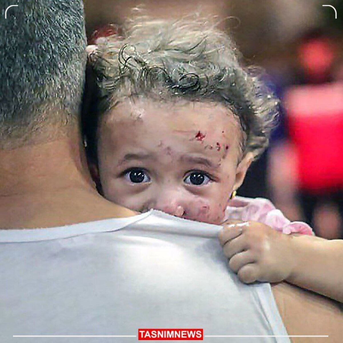 آوارگان غزه با شرایط بهداشتی ناگواری روبرو هستند